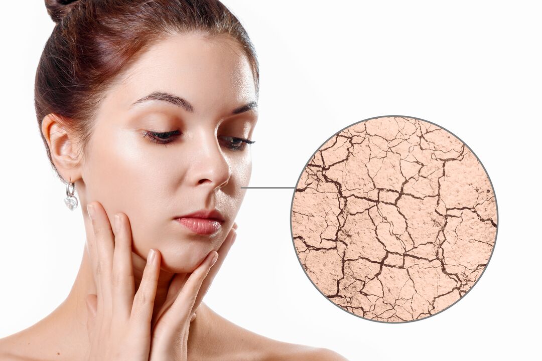 hydrater la peau sèche avec la crème Eudalie
