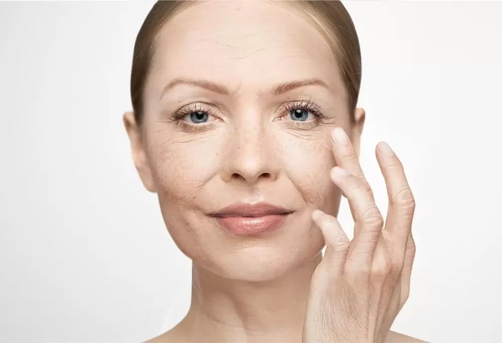 rides du visage et leur élimination avec la crème Eudalie